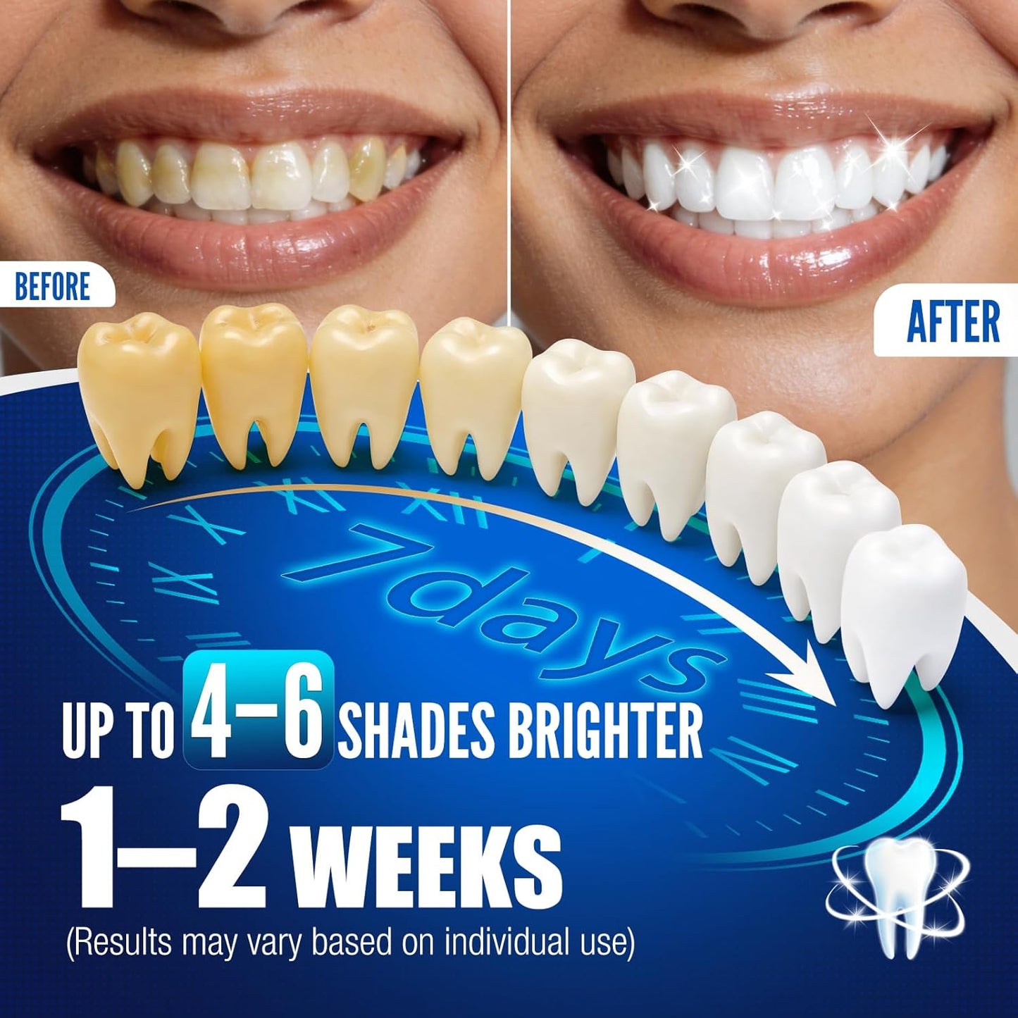 Teeth Whitening Pen Kit - 35% Carbamide Peroxide